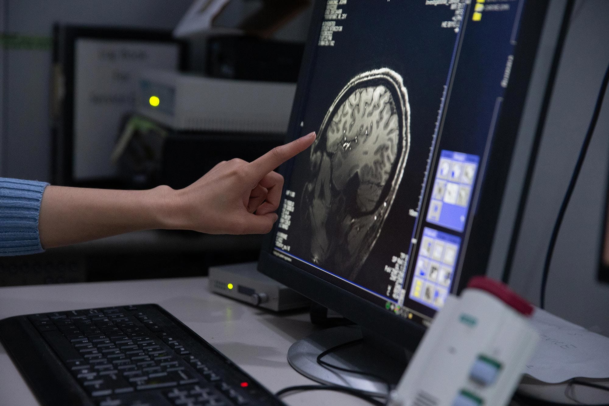 Biyu J. He's hand points to a computer screen with a scan of a human brain on it.